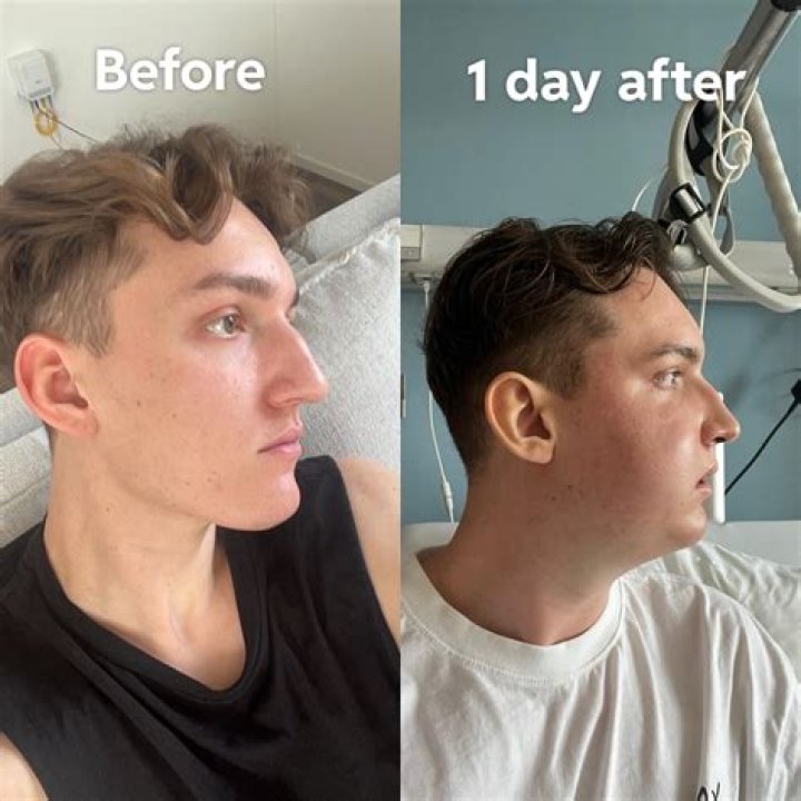 Arisce Wanzer had her jawline re-sculpted years before Ex on the Beach Fri 8 April 2022 11:01