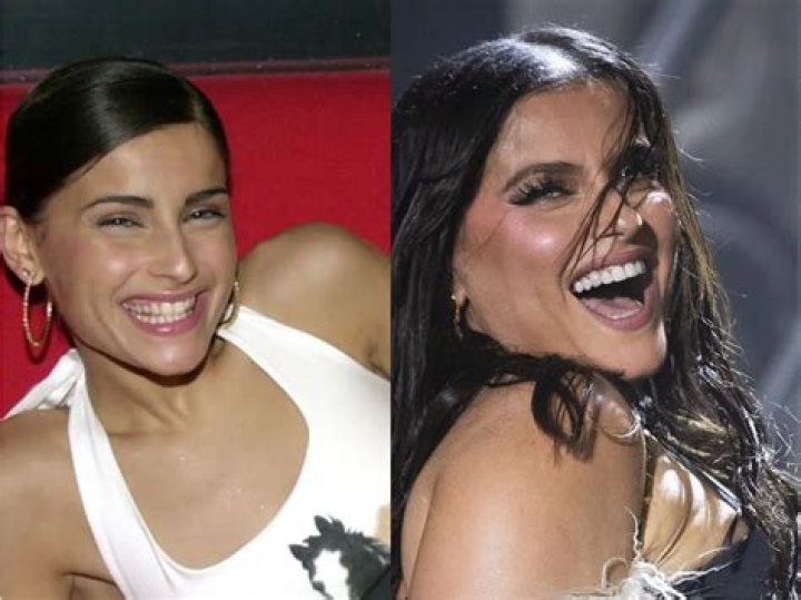Did Nelly Furtado Get Plastic Surgery: Before & After! ·