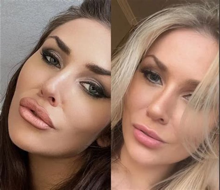 Karol G's Plastic Surgery Journey