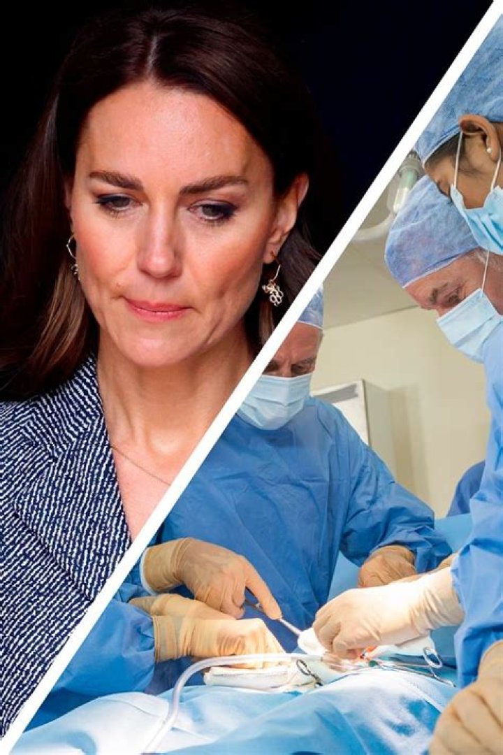 Kate Middleton's Abdominal Surgery: Unveiling The Details