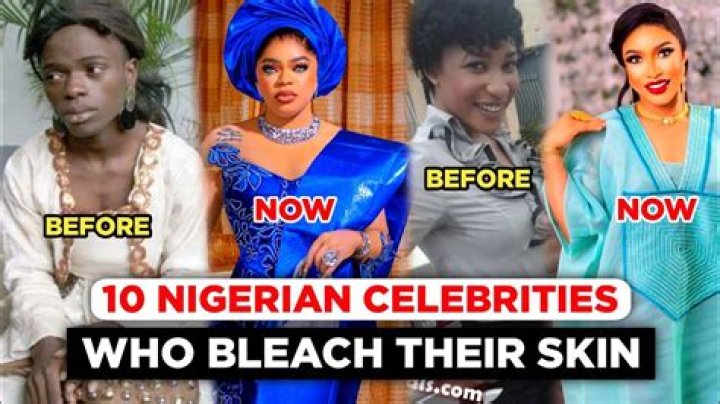 Skin Bleaching Practices Among Celebrities Revealed
