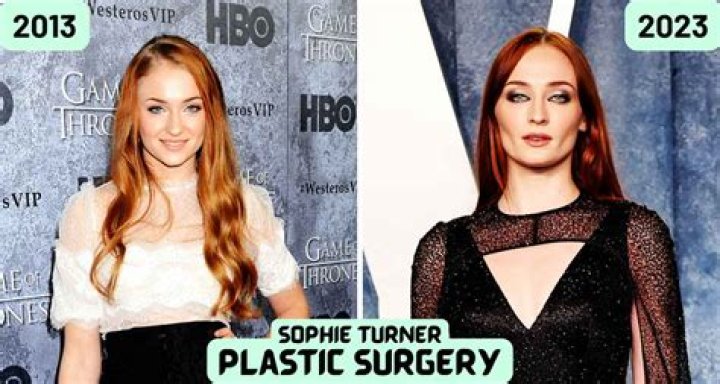 Sophie Turner Plastic Surgery: Sophie's Clear Admission or Straight Denial?