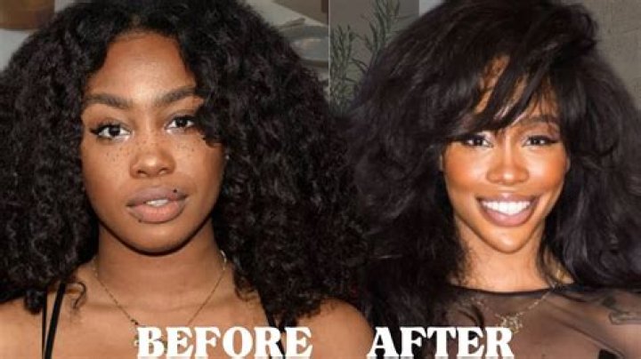 Unveiling Black Chyna's Journey: Before And After Surgery
