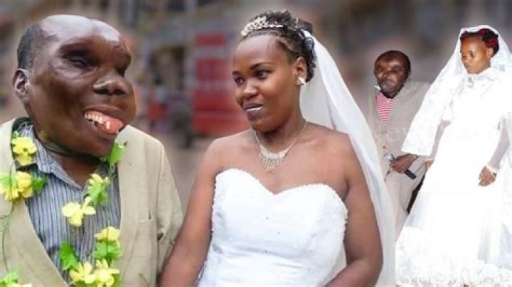 Unveiling The "Ugliest Man In The World"